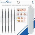 Cutting Edge Blackhead & Ingrown Hair Extractor